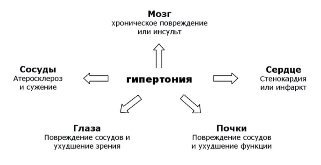 Gipertonia_risunok1.jpg