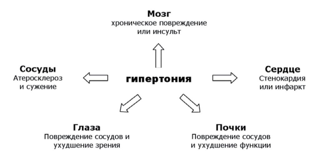 Gipertonia_risunok1.jpg